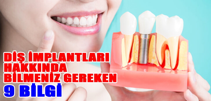Diş İmplantları Hakkında Bilmeniz Gereken 9 Bilgi